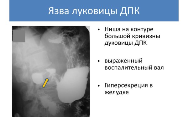 Через какой браузер можно зайти на кракен